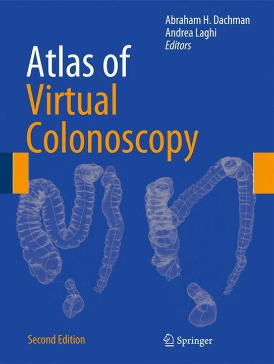 Produktbild Atlas of Virtual Colonoscopy (Englisch, Abraham H. Dachman, Andrea Laghi, 2010)