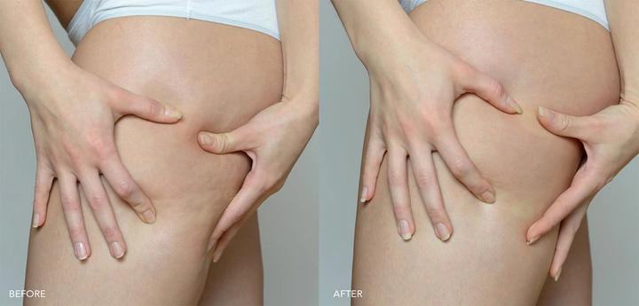 Produktbild Foreo SUPERCHARGED Firming Body Serum 100 ml (Körperlotion, 100 ml)