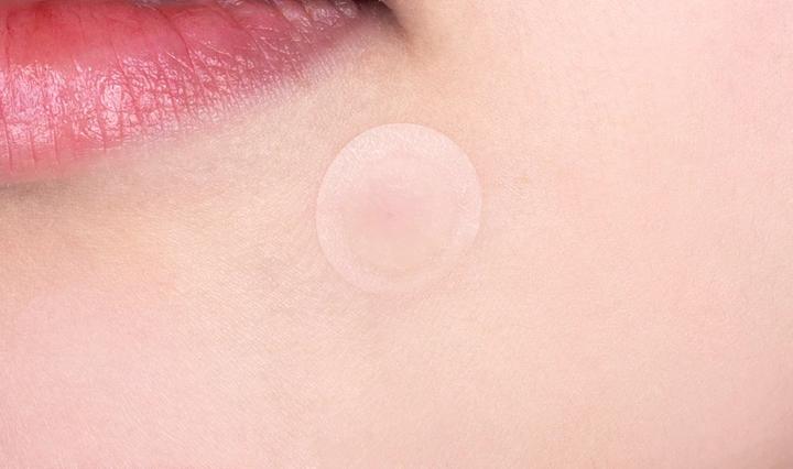 Immagine prodotto Bauerfeind Cica X Care Spot Patch