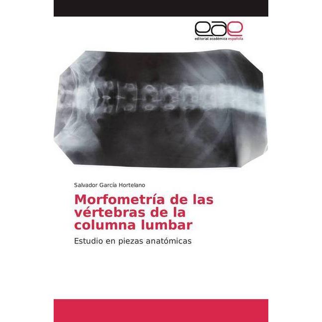 Morfometría de las vértebras de la columna lumbar, Fachbücher von Salvador García Hortelano