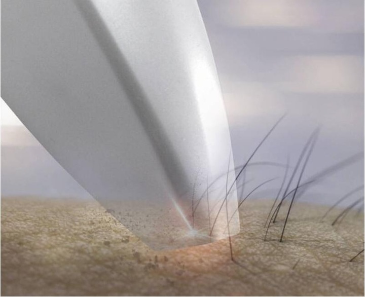 Actual product image Trisa Epilaser