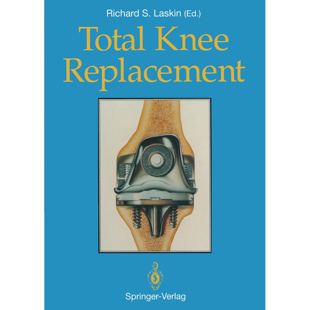 Total Knee Replacement, Fachbücher