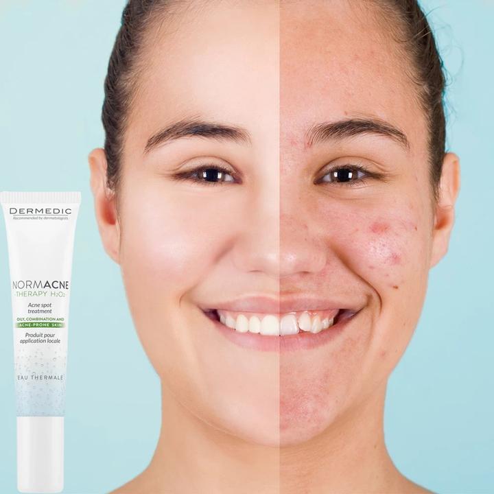 Actual product image Dermedic NORMACNE Therapy Corector - Corrector 15 g (L)