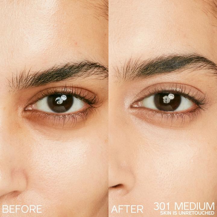 Produktbild Shiseido Radiant Lifting Concealer 301 (301 Medium, N 301)