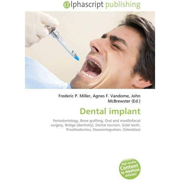Dental implant, Fachbücher von Agnes F. Vandome, Frederic P. Miller, John McBrewster