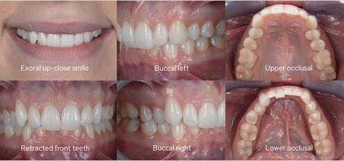 Produktbild Godox MF12 DK1 Dental Flash Kit (Makroblitz, Sony)