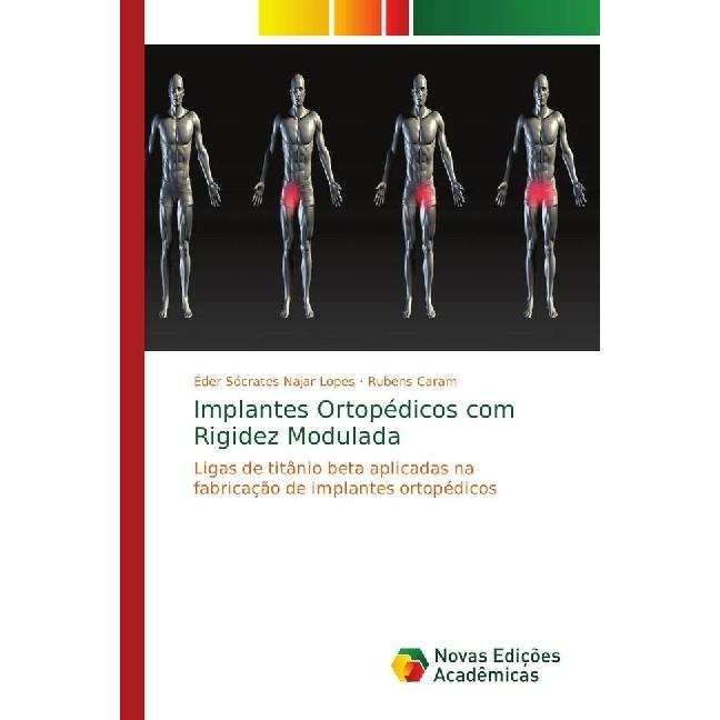 Implantes Ortopédicos com Rigidez Modulada, Fachbücher von Rubens Caram, Éder Sócrates Najar Lopes