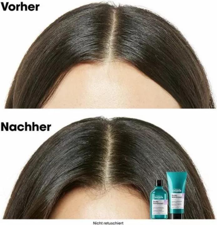 Produktbild L'Oréal Professionnel Serie Expert Scalp Advanced Anti-Discomfort Dermo-Regulator Refill (500 ml, Flüssiges Shampoo)