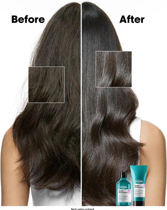 Image du produit L'Oréal Professionnel Série Expert Scalp Advanced - Anti-Discomfort Dermo-régulateur (Shampoing liquide, 300 ml)