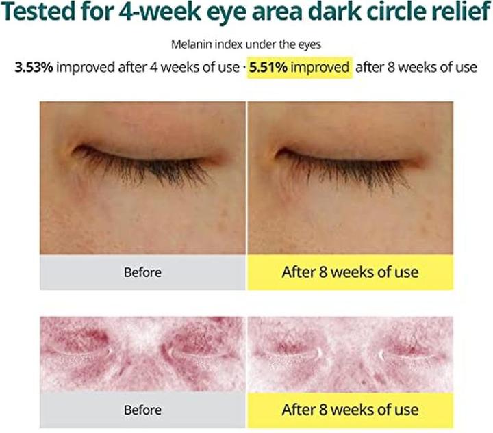 Image du produit Goodal Green Tangerine (Crème pour les yeux, 30 ml, Jour + nuit)