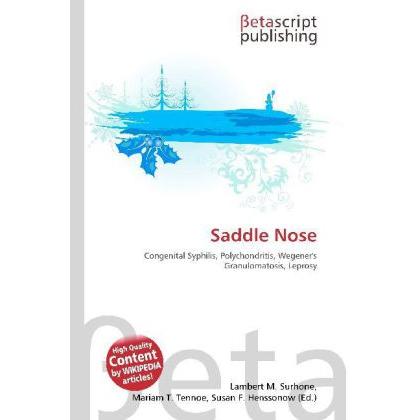 Saddle Nose, Fachbücher von Lambert M. Surhone, Mariam T. Tennoe, Susan F. Henssonow