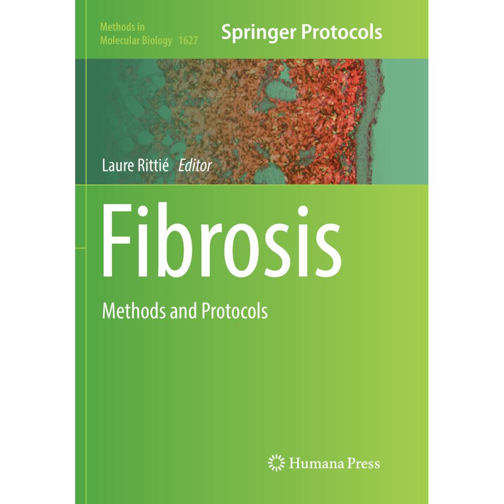 Thumbnail - Fibrosis, Fachbücher von Laure Rittié
