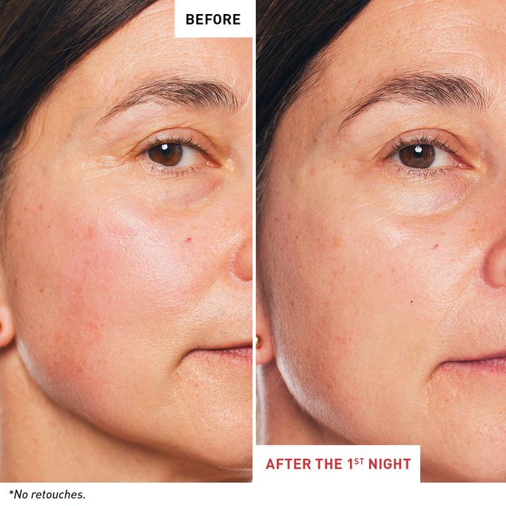 Immagine prodotto Erborian Skin Therapy Multi-Perfecting (10 ml, Crema notte)