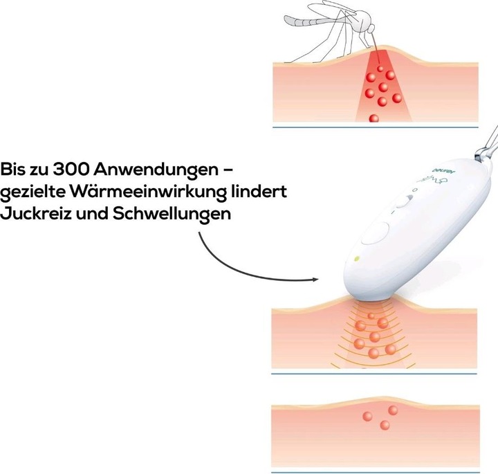 Actual product image Beurer BR 10 Insect bite healer