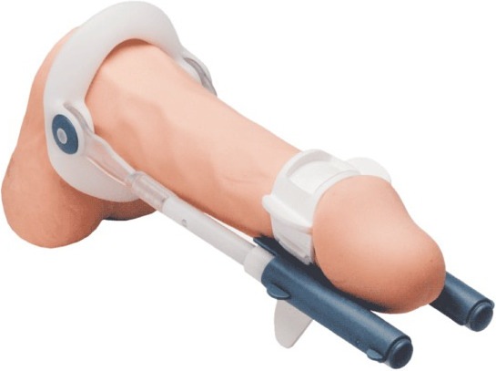 Immagine prodotto Male Edge Kit di base per l'ingrandimento del pene