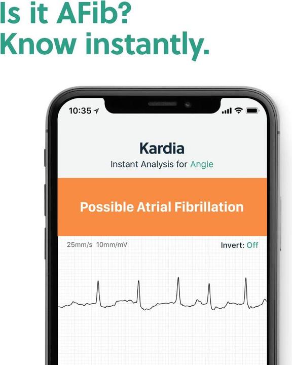 Actual product image AliveCor Kardiamobile 6L