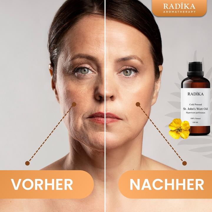 Produktbild Radika Johanniskrautöl, Johanniskrautöl, 100 % Rein, BIO, natürlich, 100 ml