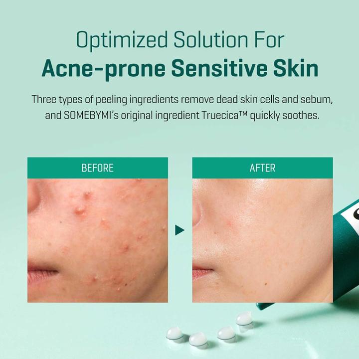 Immagine prodotto Some By Mi AHA.BHA.PHA 4Days Super Miracle Spot Crema All Kill (30 ml, Crema 24h)
