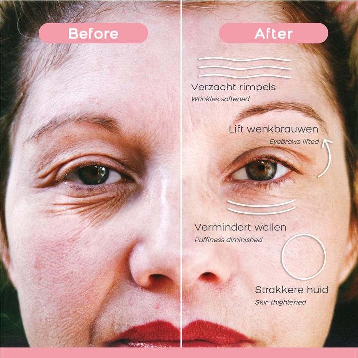 Image du produit DermaWand Dispositif de soins de la peau