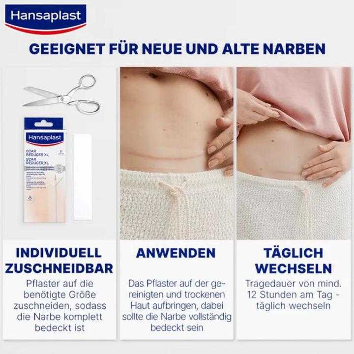 Actual product image Hansaplast Narben Reduktion (21 x)
