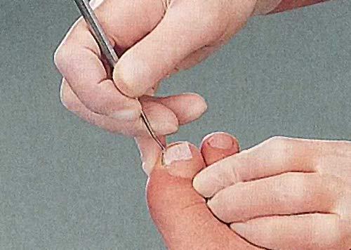 Produktbild Kosmetex Tamponade Set