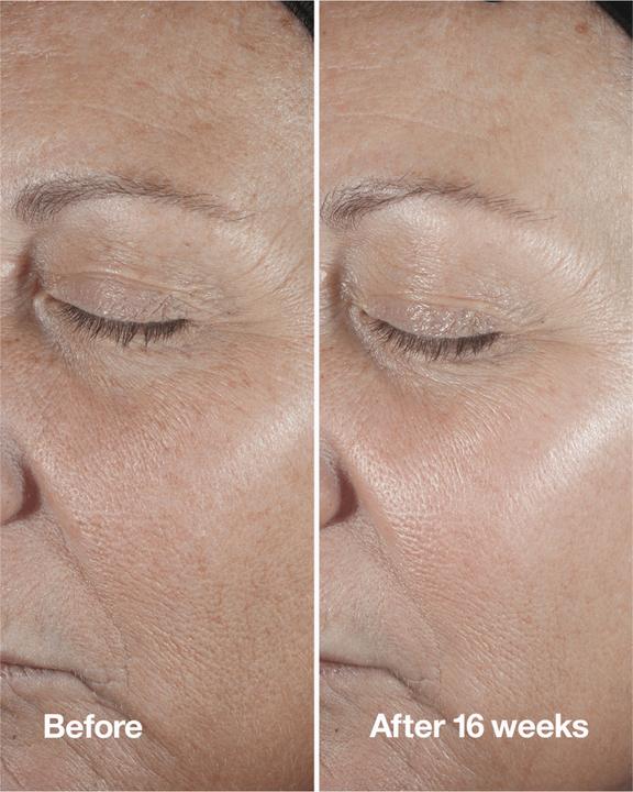 Produktbild Clinique Smart Clinical Repair (100 ml)