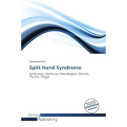 Split Hand Syndrome, Fachbücher von Jules Reene