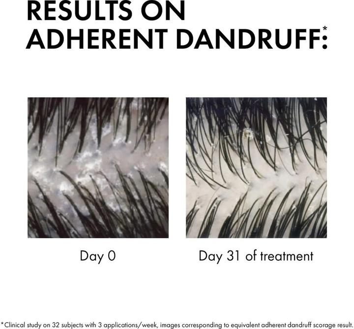 Actual product image Vichy Dercos Anti-Dandruff (500 ml, Liquid shampoo)