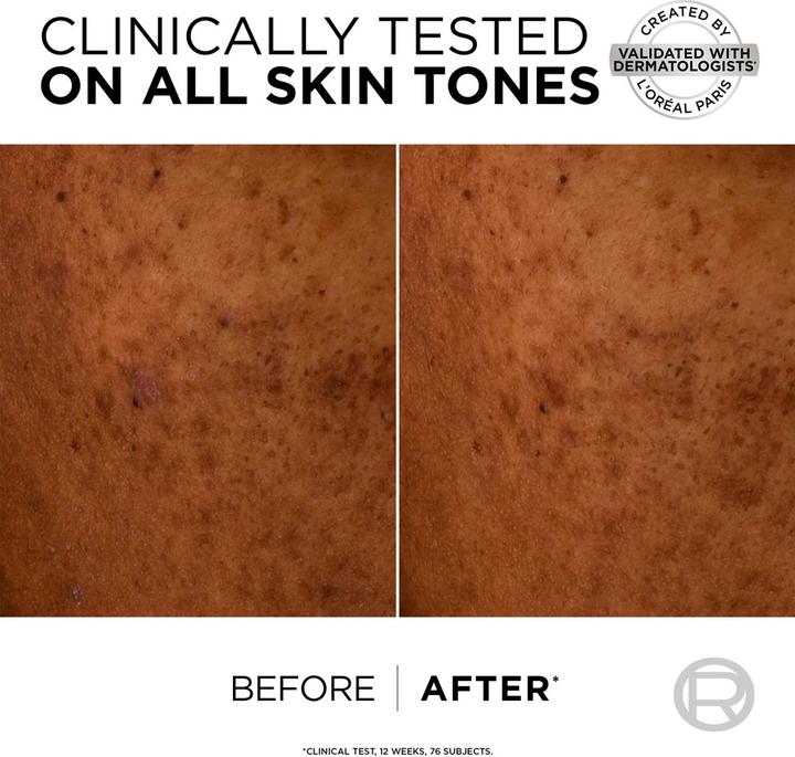 Image du produit L'Oréal Paris Fluide UV Bright Reveal Dark Spot (Crème solaire, SPF 50, 50 ml)