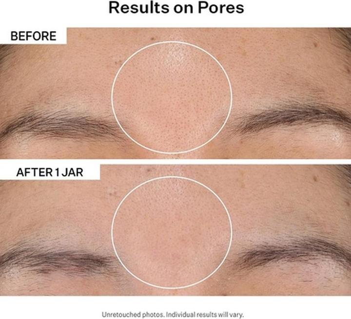 Actual product image StriVectin Advanced Acid (Cleansing scrub)