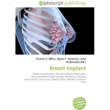 Breast Implant, Fachbücher von Agnes F. Vandome, Frederic P. Miller, John McBrewster