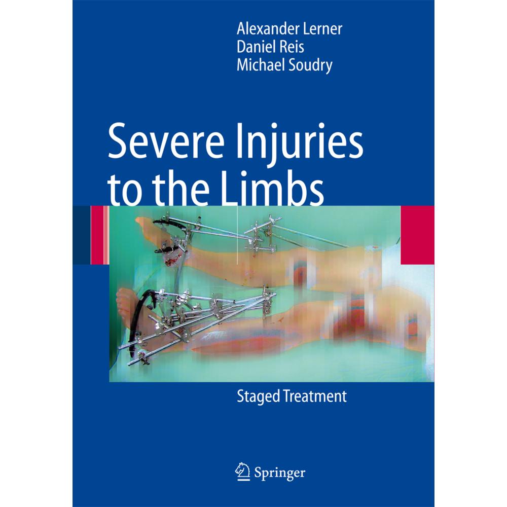 Thumbnail - Severe Injuries to the Limbs, Fachbücher von Michael Soudry, Alexander Lerner, Daniel Reis