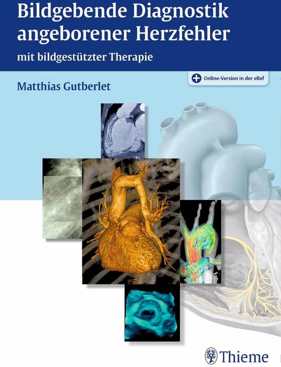 Produktbild Bildgebende Diagnostik angeborener Herzfehler (Deutsch, Matthias Gutberlet, 2016)