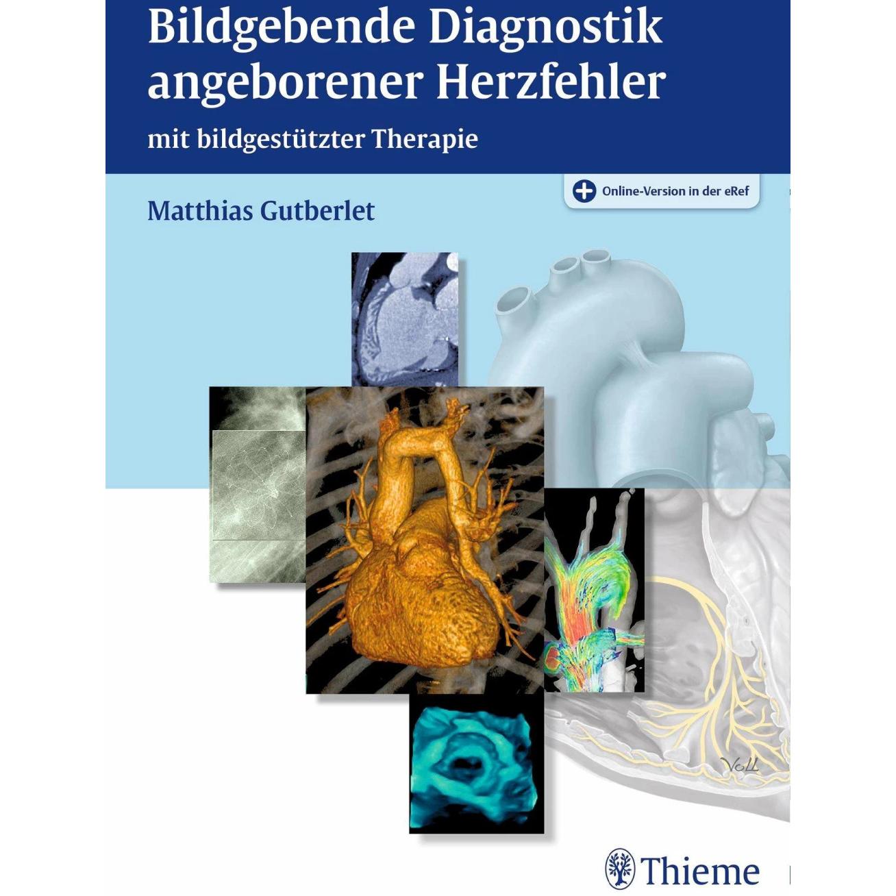 Bildgebende Diagnostik angeborener Herzfehler, Fachbücher von Matthias Gutberlet