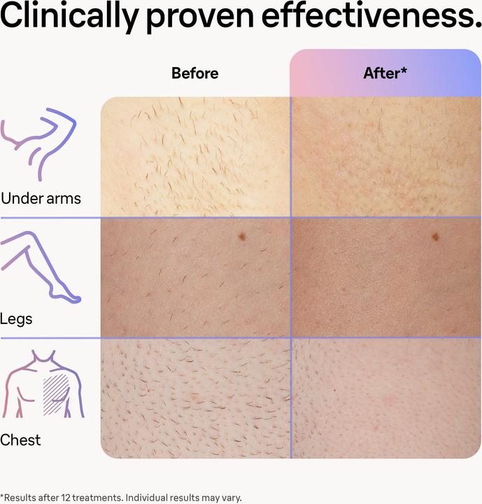 Produktbild Braun Skin i·expert