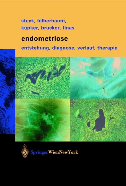 Produktbild Endometriose (Deutsch, Cosima Brucker, Dominique F. Finas, Ricardo E. Felberbaum, Thomas Steck, Wolfgang Küpker, 2012)