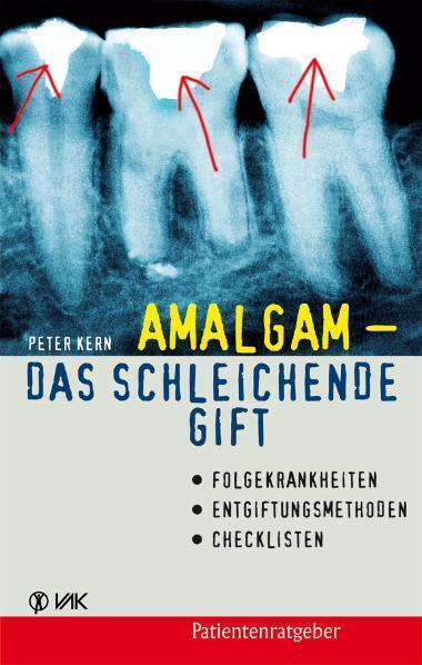 Produktbild Amalgam - das schleichende Gift (Deutsch, Peter Kern, 2010)