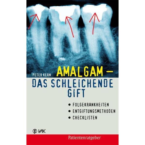 Amalgam - das schleichende Gift, Ratgeber von Peter Kern