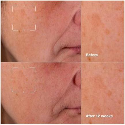 Actual product image Clinique Even Better Clinical Dark Spot Clearing Serum (30 ml)