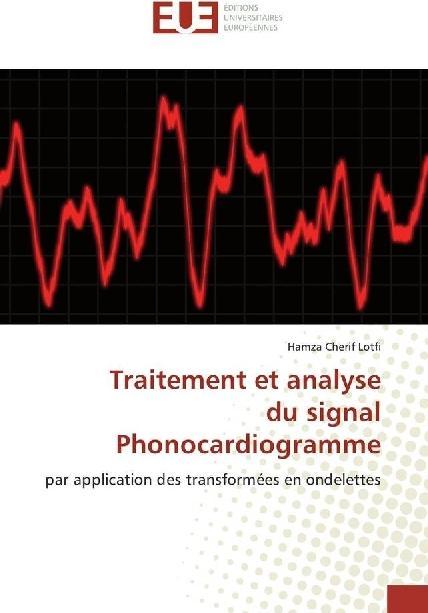 Produktbild Traitement et analyse du signal Phonocardiogramme (Hamza Cherif Lotfi, 2017)