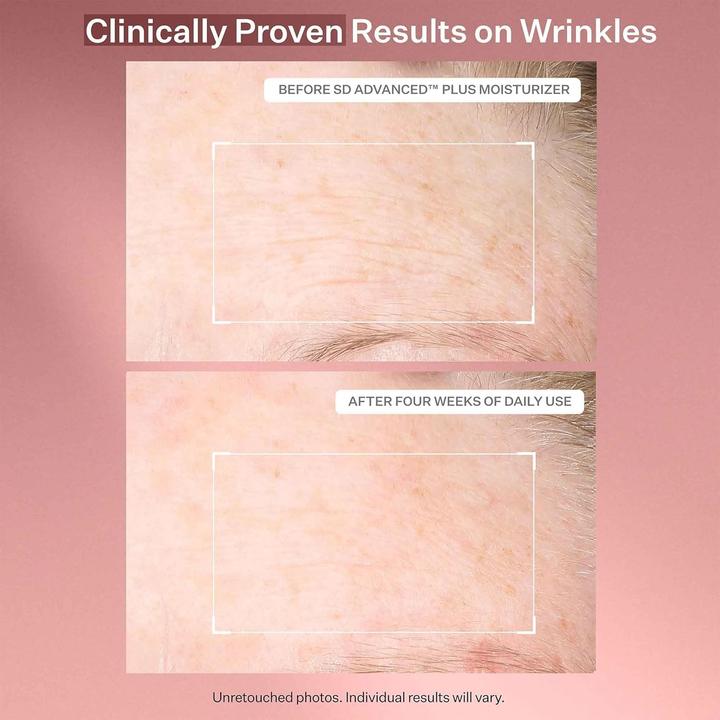 Actual product image StriVectin Advanced Plus (118 ml)