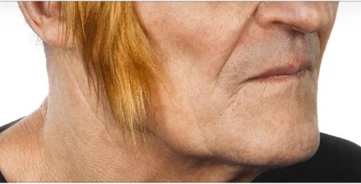 Produktbild Metamorph Koteletten