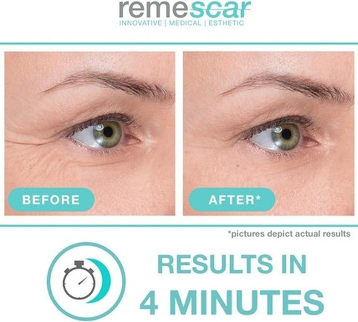 Produktbild Remescar Crow s Feet 8ml (Fusscrème & Fussgel, 8 ml)