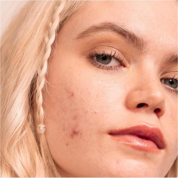 Produktbild Dermalogica Clear Start - Post-Breakout Fix (Körpercreme)