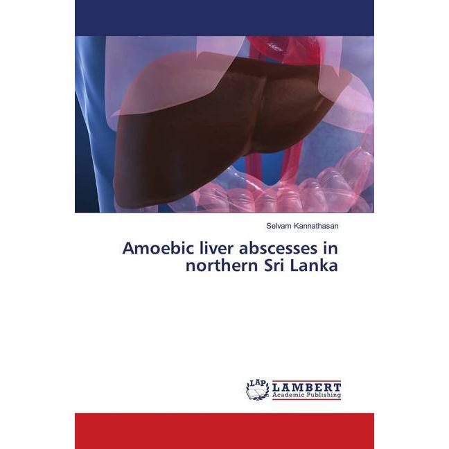 Amoebic liver abscesses in northern Sri Lanka, Fachbücher von Selvam Kannathasan