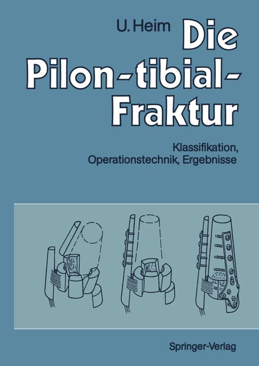 Produktbild Die Pilon-tibial-Fraktur (Deutsch, Urs Heim, 2012)