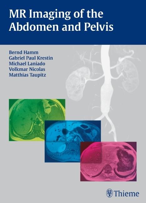 Produktbild MR Imaging of the Abdomen and Pelvis (Englisch, Matthias Taupitz, Volkmar Nicolas, 2009)