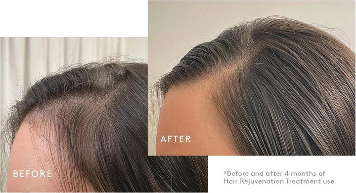 Immagine prodotto Virtue Labs Trattamento di ringiovanimento dei capelli Flourish Set di fornitura per 1 mese (Set per la cura dei capelli)