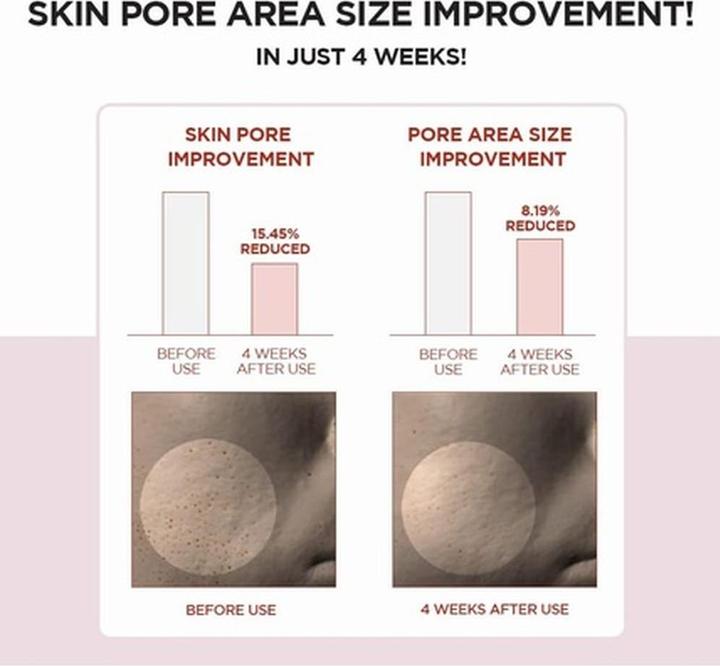 Produktbild Skin1004 Poremizing Clear Toner (Gesichtswasser, 210 ml)