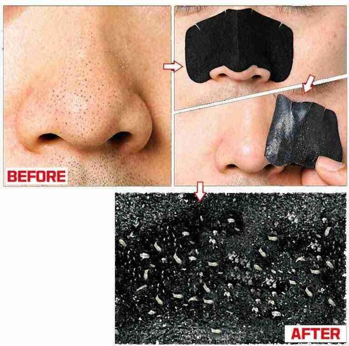 Productafbeelding Holika Holika Varkensneus Helder Zwart Hoofd 3 Stappenkit Sterk